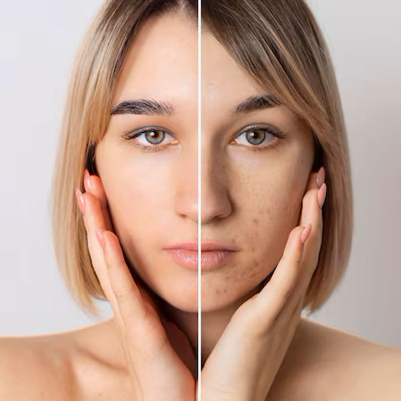 Women with before and after skincare